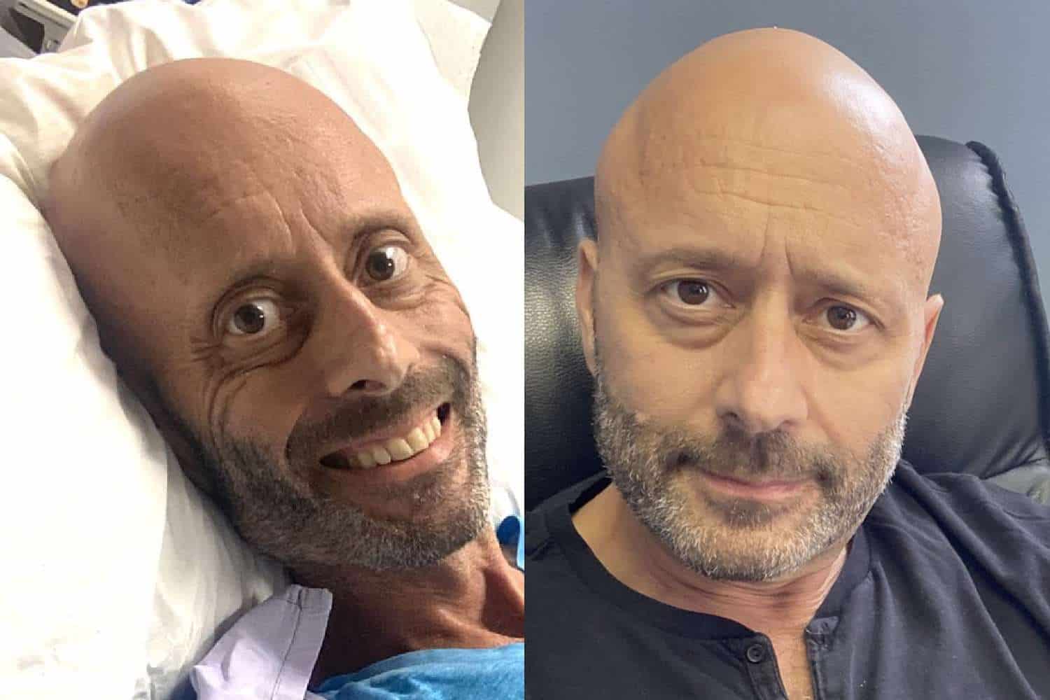 mark pilgrim lung cancer