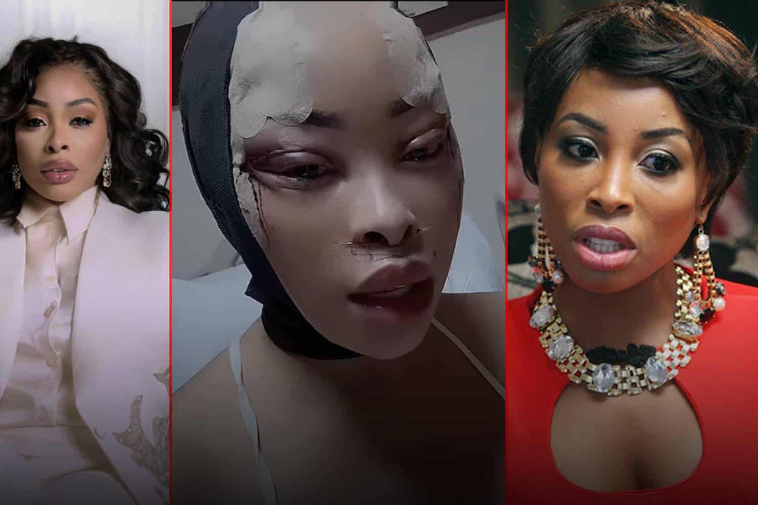 khanyi mbau plastic surgery