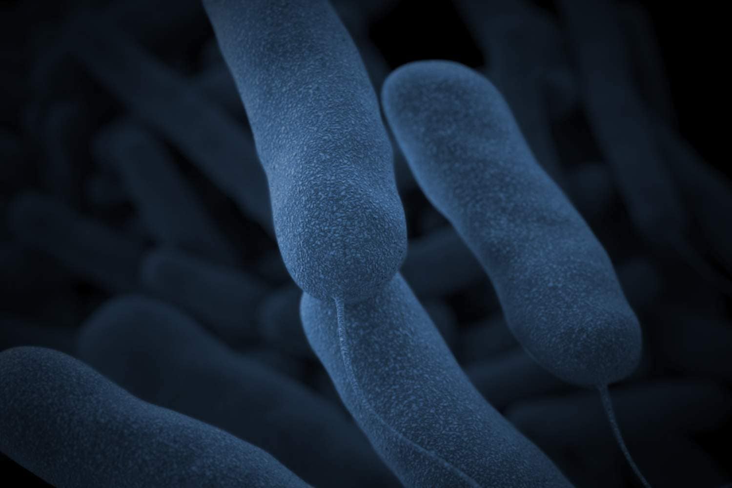 legionnaires disease